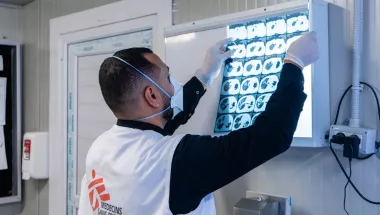 In Libyen führen wir Maßnahmen zur Bekämpfung von Tuberkulose durch. Arzt hängt Röntgenaufnahmen auf, um diese zu bewerten