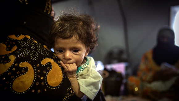 Irak Mossul Säuglinge Babys Mangelernährung