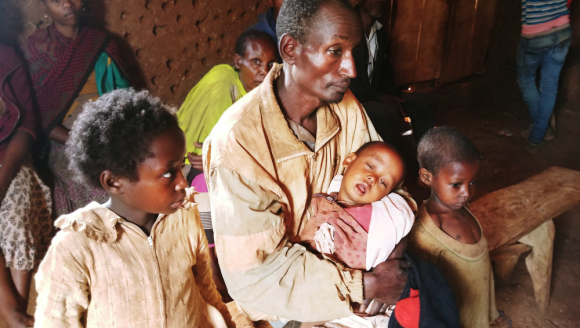 Vater mit mangelernährtem Kind in Äthiopien