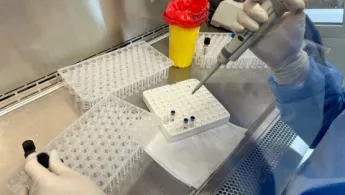 In einem Labor in der Ukraine wird auf Tuberkulose getestet Labortest in der Ukraine