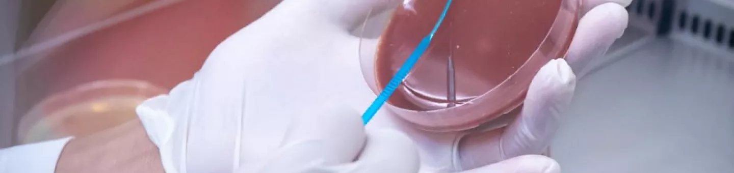 In einer Petrischale wird ein Test zu antimikrobiellen Resistenzen gemacht. Petrischale mit einem Test auf antimikrobielle Resistenzen