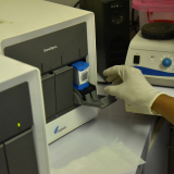 Für eine schnelle TB-Diagnose wird in das Gerät eine Probe eingelegt